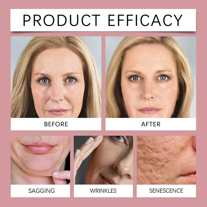 โจ๐๐ผ๐ฟ๐ฒ๐ฎ๐ป ๐๐ผ๐น๐น๐ฎ๐ด๐ฒ๐ป ๐ข๐๐ฒ๐ฟ ๐ก๐ถ๐ด๐ต๐ ๐๐ฎ๐ฐ๐ฒ ๐ ๐ฎ๐๐ธโจ | ๐๐๐ ๐ญ ๐๐ฒ๐ ๐ญ ๐๐ฟ๐ฒ๐ฒ!